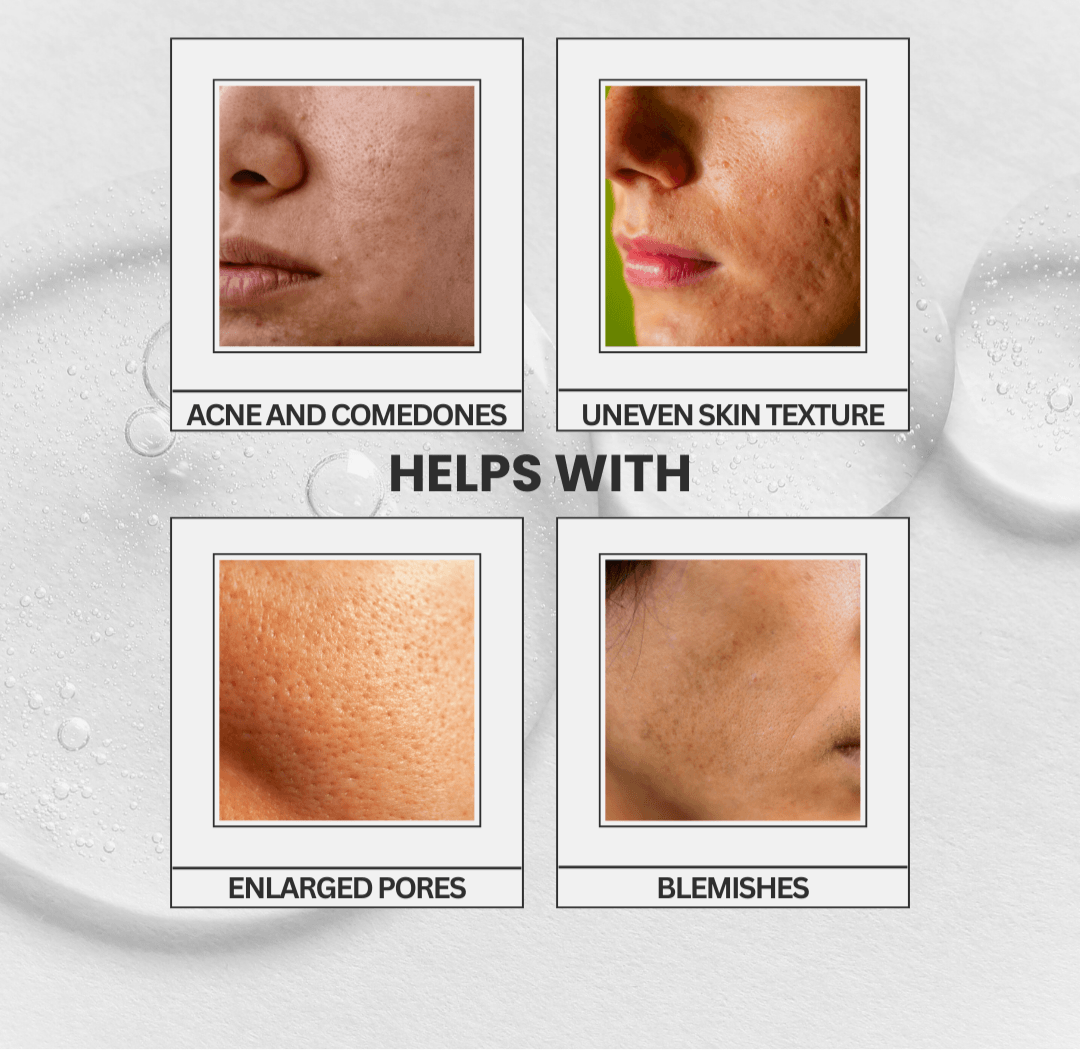 Aurore Refine | Intensive Pore-Perfecting Treatment Essence - belle femme