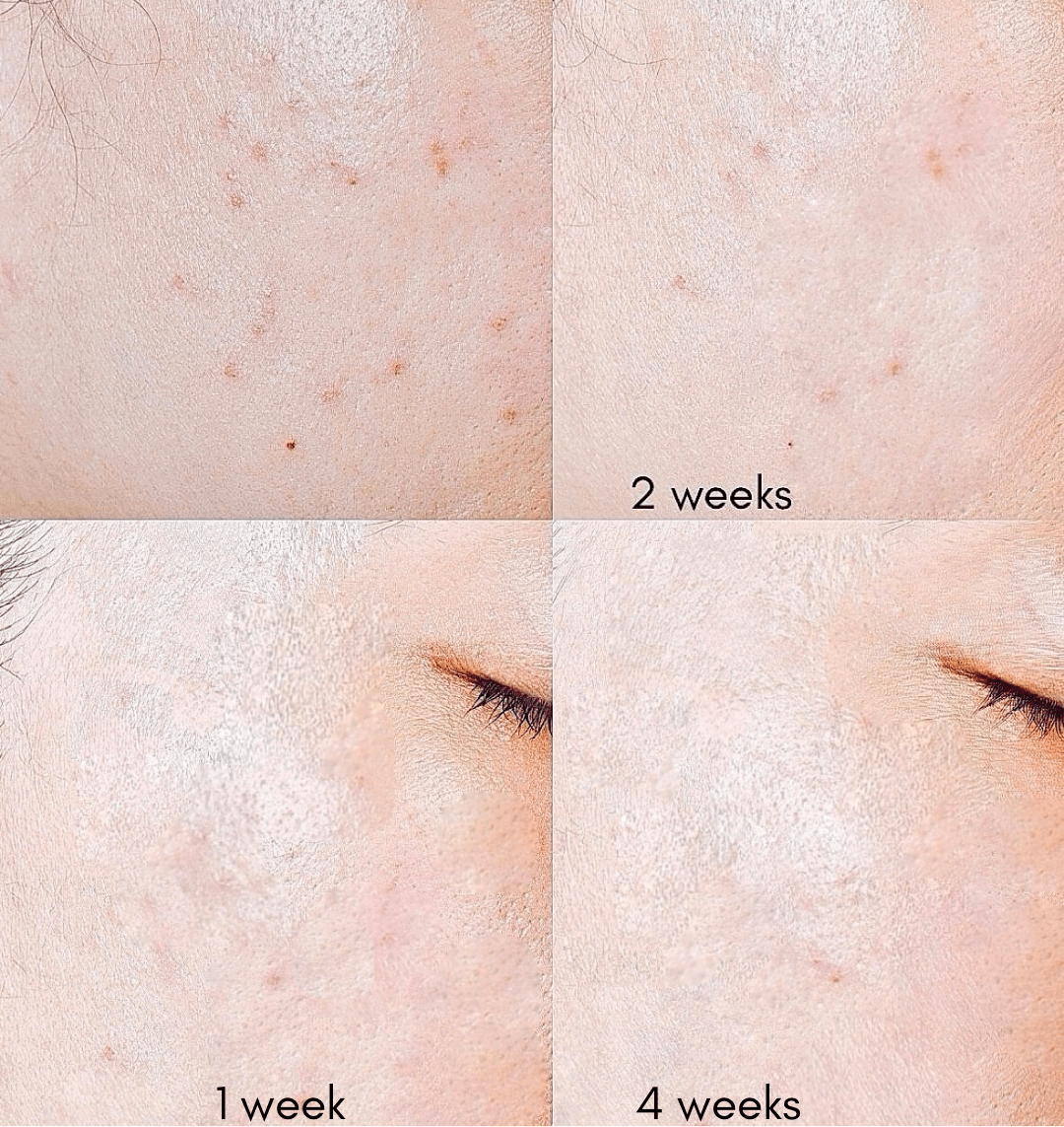 Gentle Soothe Night Serum