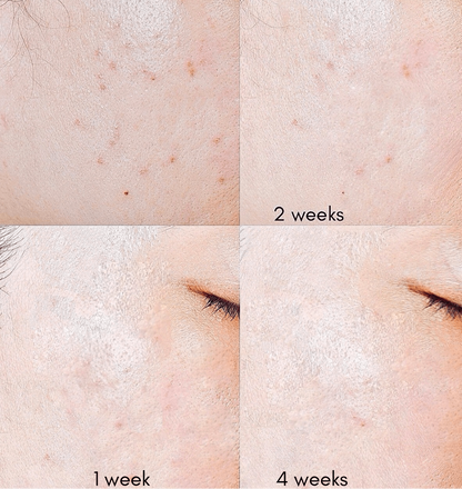 Gentle Soothe Night Serum