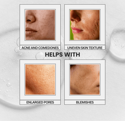 Aurore Refine | Intensive Pore-Perfecting Treatment Essence - belle femme