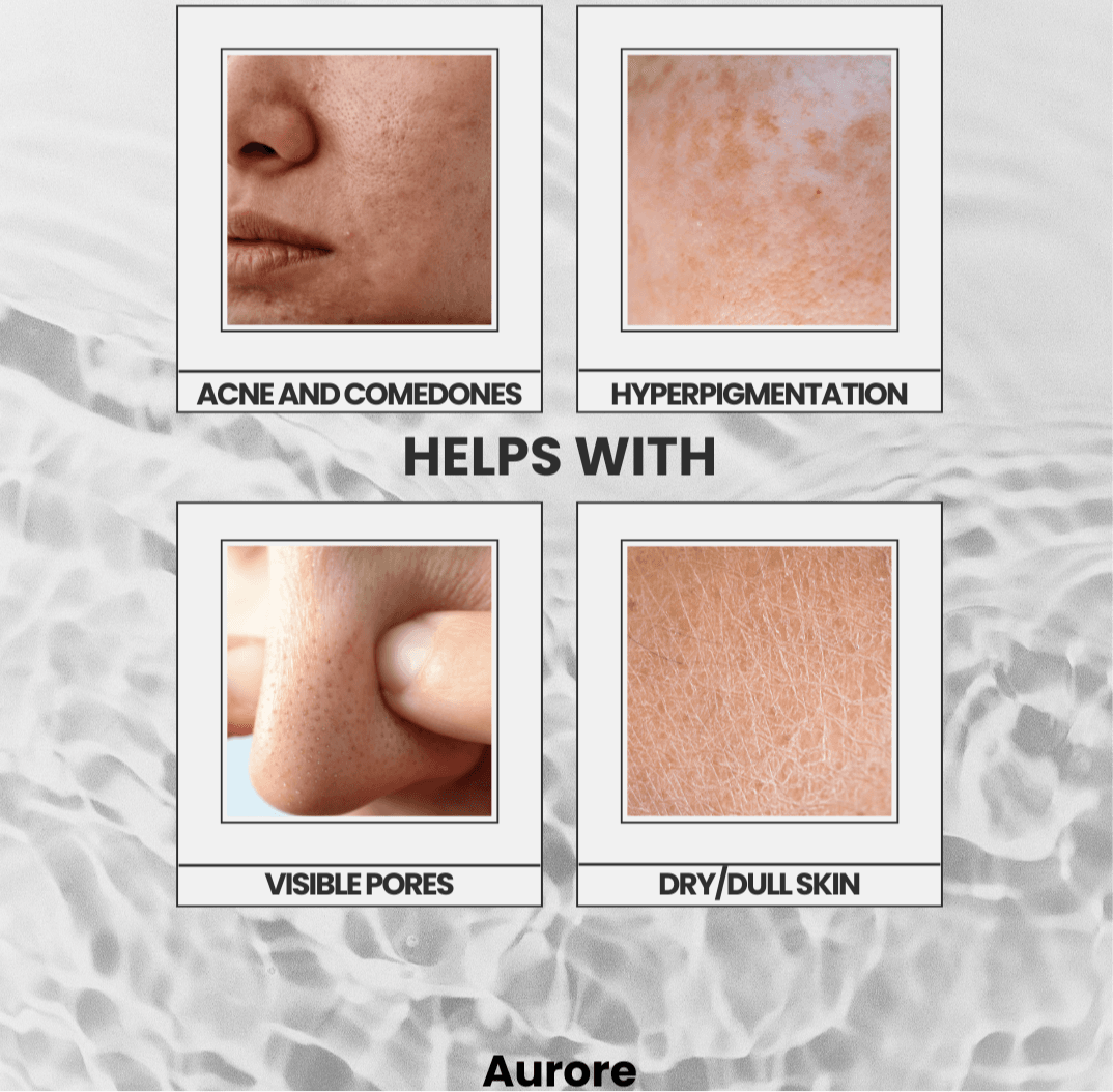 Aurore Rejuvenating Kit | Pore Vacuum + Rejuvenating Solution - belle femme