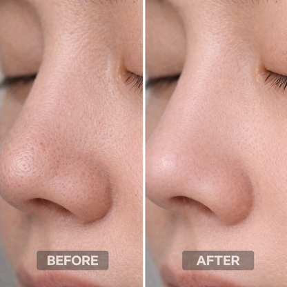 Clarifying Cleanser